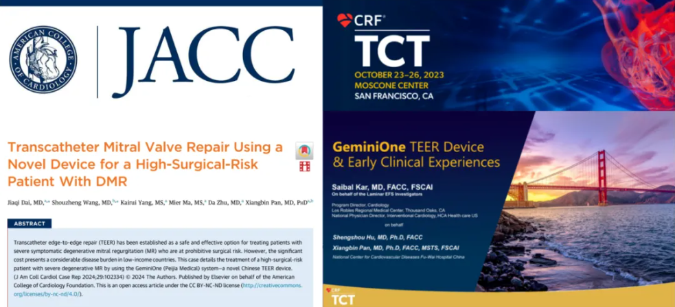 INNOVATIVE TRANSCATHETER EDGETO-EDGE REPAIR (TEER) SYSTEM GeminiOne®: RESULTS OF DMR TREATMENT PUBLISHED FOR THE FIRST TIME