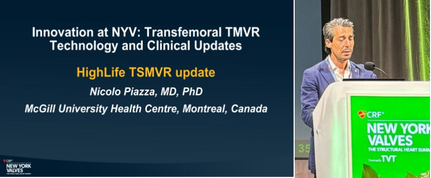 HighLife® Transseptal Mitral Valve Replacement (TSMVR) System: Latest Updates Presented at New York Valves 2024, FDA Approved IDE Application to Initiate US Piovtal Study for Treatment of Mitral Regurgitation