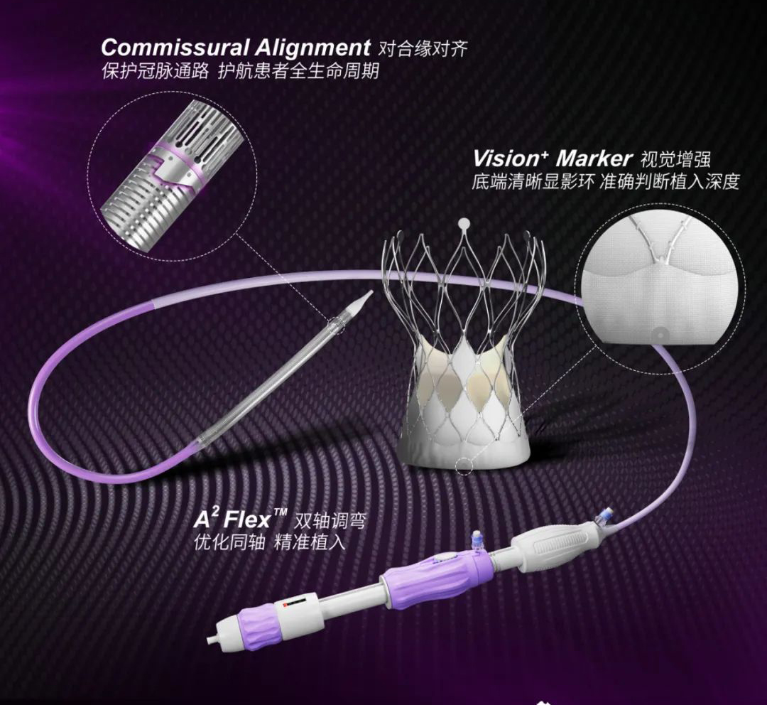 沛嘉医疗TaurusMax经导管主动脉瓣系统获NMPA批准上市