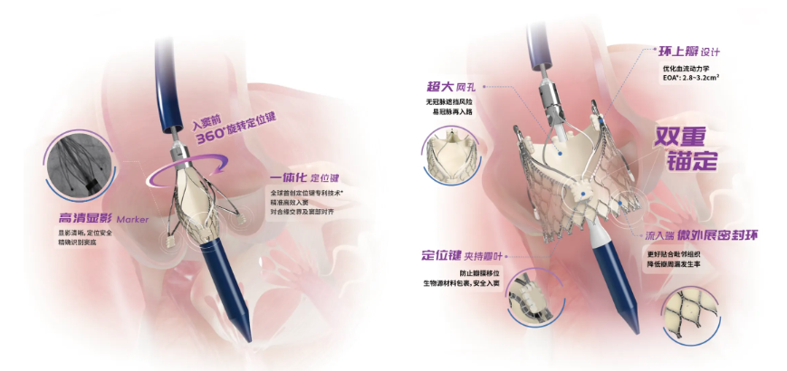 引力播：主动脉瓣反流微创介入治疗实现领跑跨越 沛嘉医疗创新产品获批上市